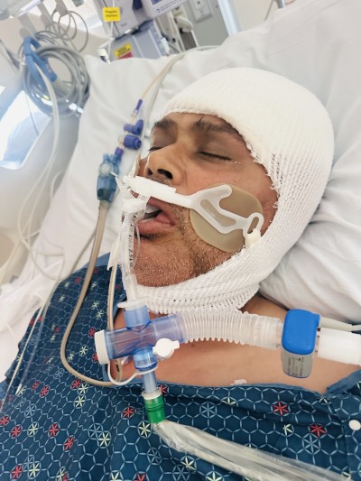 Journalist Jeevant Wagley Critically Ill, Remains Unconscious Over a Week After Brain Tumor Surgery