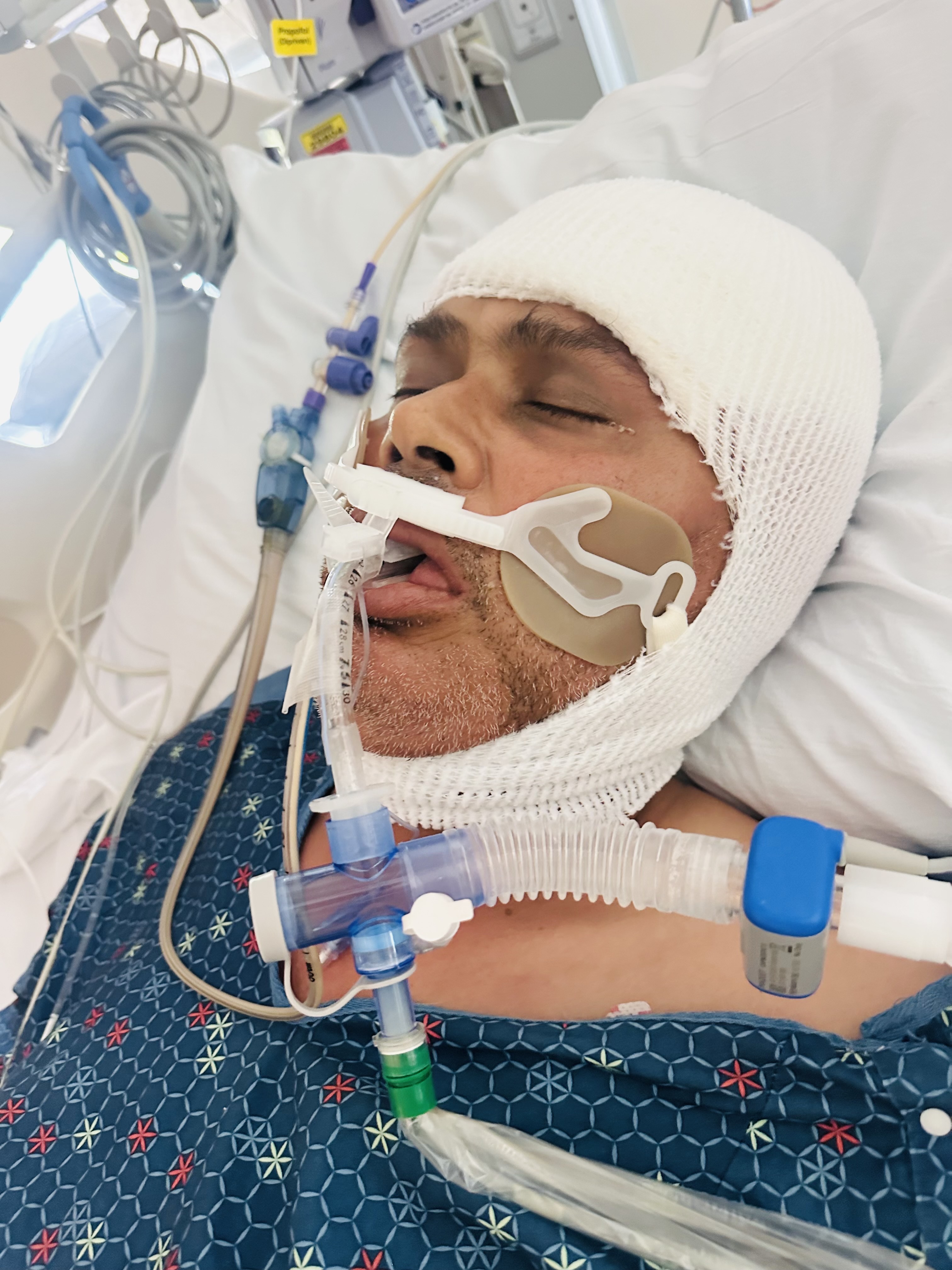 Journalist Jeevant Wagley Critically Ill, Remains Unconscious Over a Week After Brain Tumor Surgery