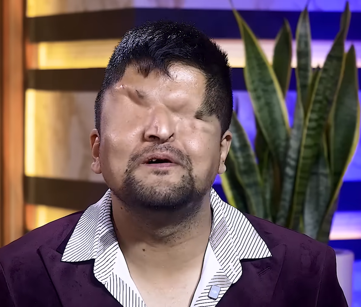 Prasai's Outrage: 'Oli's Arrogant Behavior Made Us Frustrated'